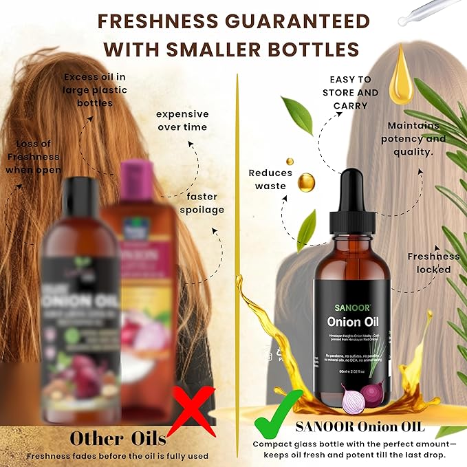 Himalayan Red Onions Oil | 100% Pure (2.02oz)| Cold-pressed, stimulates hair growth, strengthens follicles, and treats infections for healthier hair | 60ml