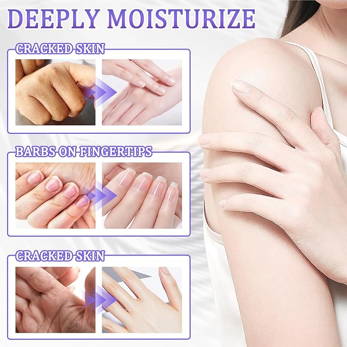 Hand Mask Moisturizing Gloves 6 Pack,Hydrating Hand Mask for Women,Soft Gloves for Dry Cracked Skin A