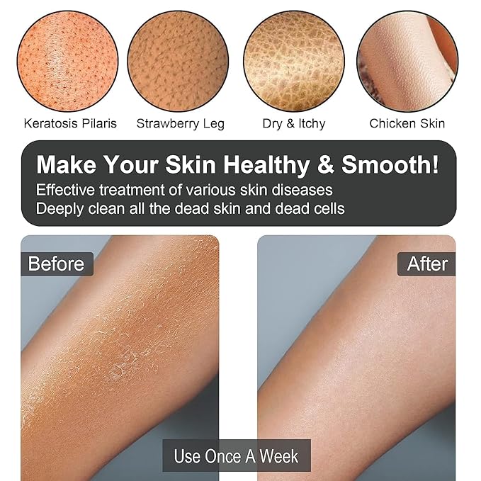 Yiclick Heavy Exfoliating Gloves, Exfoliating Body Scrubber for Bath Shower Exfoliation, Body Scrub Exfoliator For Dead Skin Remover, Exfoliate Sponge Loofah Washcloth Mitt Men Women (12 Grey)