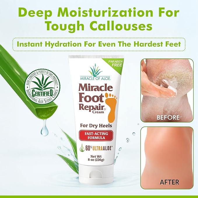 Miracle Foot Repair Cream (8 oz / 4-Pack) Repairs Dry Cracked Heels and Feet, 60% Pure UltraAloe Moisturizes, Softens, and Repairs