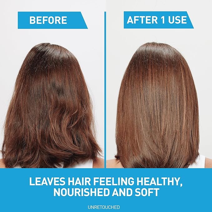 CeraVe Hydrating Anti Dandruff Shampoo and Conditioner Set, Pyrithione Zinc Dandruff Treatment With Ceramides, Hyaluronic Acid & Niacinamide, Helps Elimanate Flakes & Reduce Itchy Scalp