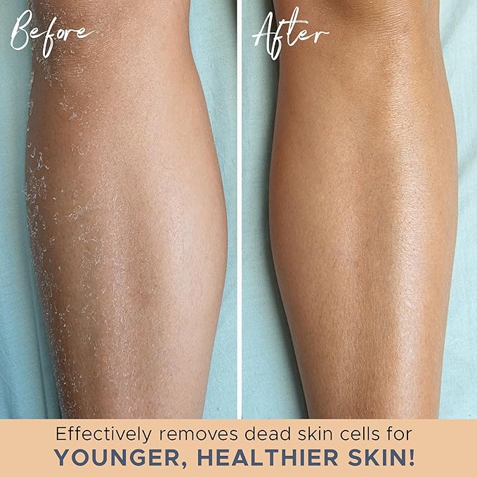 Exfoliating Glove (4 pcs, 2 Pairs) - Heavy Shower Gloves for Body Scrub, Exfoliates & Removes Dead Skin